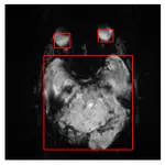 Bounding-box for Brain Cancer MRI